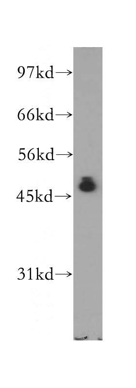 HeLa cells were subjected to SDS PAGE followed by western blot with Catalog No:111642(NFKBIB antibody) at dilution of 1:500