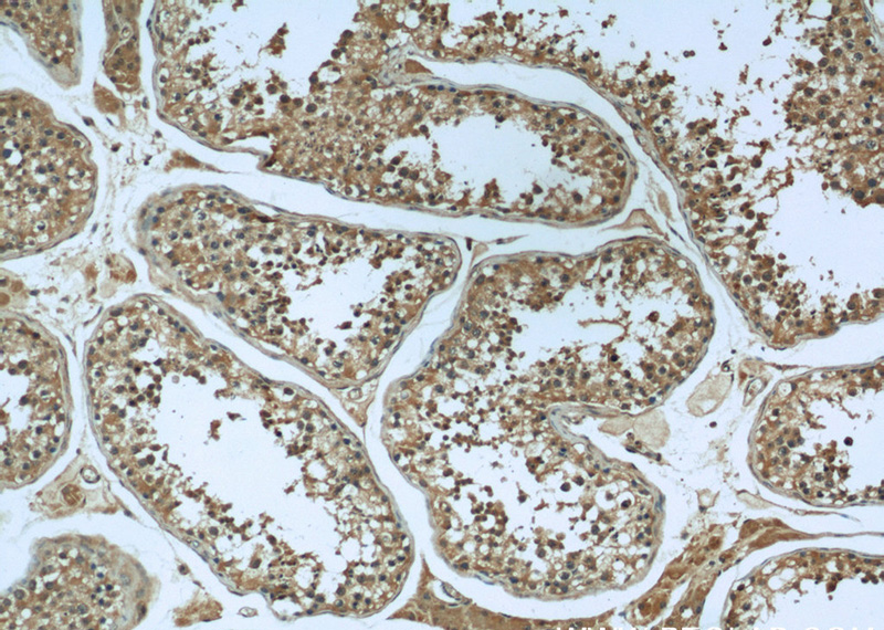 Immunohistochemical of paraffin-embedded human testis using Catalog No:108833(CAPN1 antibody) at dilution of 1:50 (under 10x lens)