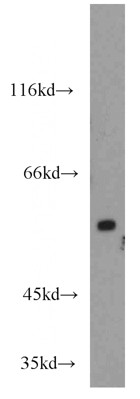 mouse brain tissue were subjected to SDS PAGE followed by western blot with Catalog No:116305(TRIM23 antibody) at dilution of 1:1000