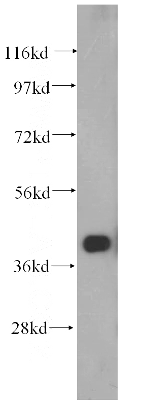 mouse liver tissue were subjected to SDS PAGE followed by western blot with Catalog No:110453(FAH antibody) at dilution of 1:500
