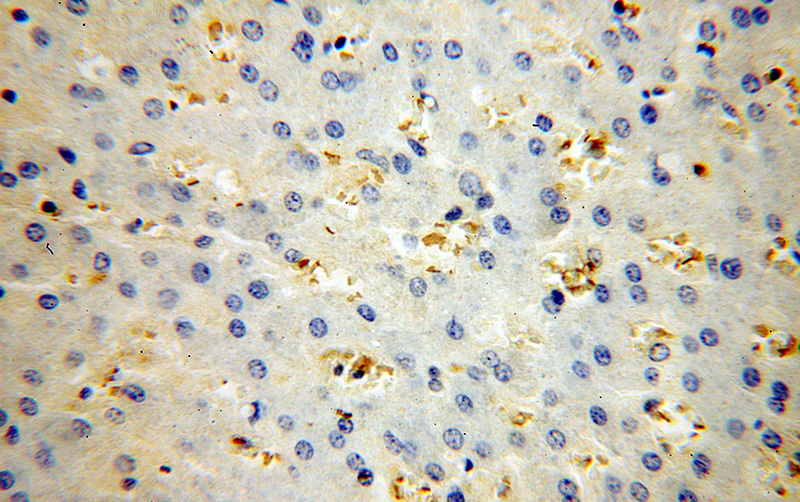 Immunohistochemical of paraffin-embedded human liver using Catalog No:111266(HBB antibody) at dilution of 1:100 (under 40x lens)