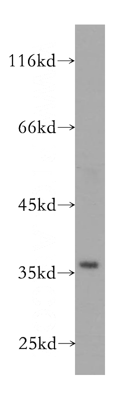 HeLa cells were subjected to SDS PAGE followed by western blot with Catalog No:110995(GNB2 antibody) at dilution of 1:500
