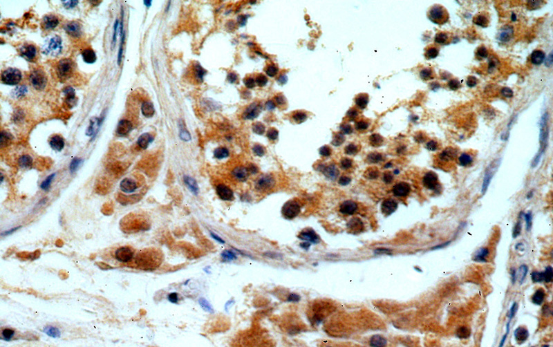 Immunohistochemical of paraffin-embedded human testis using Catalog No:110037(DTX2 antibody) at dilution of 1:50 (under 40x lens)