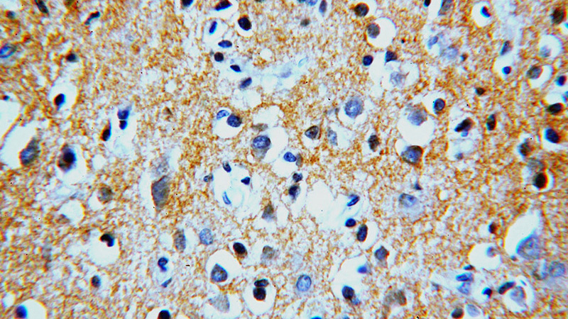 Immunohistochemical of paraffin-embedded human brain using Catalog No:114020(ATP2B2 antibody) at dilution of 1:100 (under 40x lens)