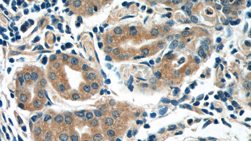 Immunohistochemistry of paraffin-embedded human stomach tissue slide using Catalog No:117083(AZI2 Antibody) at dilution of 1:50 (under 40x lens)