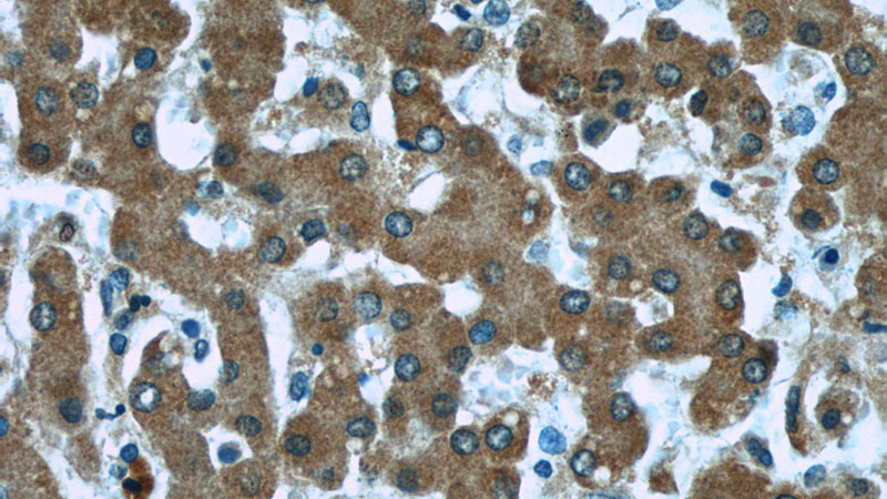 Immunohistochemistry of paraffin-embedded human liver tissue slide using Catalog No:107624(TIMM44 Antibody) at dilution of 1:50