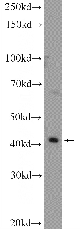 A549 cells were subjected to SDS PAGE followed by western blot with Catalog No:115368(SLC35F2 Antibody) at dilution of 1:600