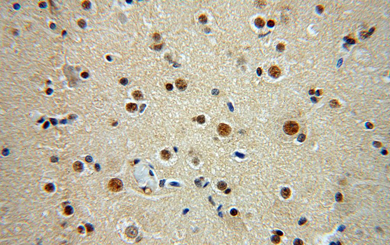 Immunohistochemical of paraffin-embedded human brain using Catalog No:114608(RBM26 antibody) at dilution of 1:100 (under 40x lens)