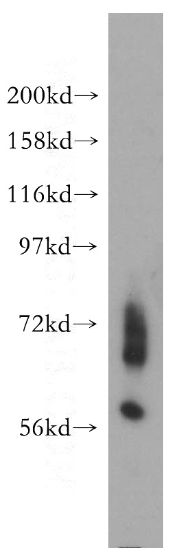 mouse brain tissue were subjected to SDS PAGE followed by western blot with Catalog No:110246(ENC1 antibody) at dilution of 1:400
