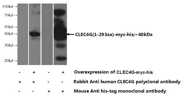 Transfected HEK-293 cells were subjected to SDS PAGE followed by western blot with Catalog No:109385 (CLEC4G Antibody) at dilution of 1:1000