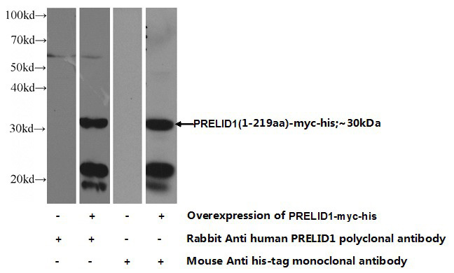 Transfected HEK-293 cells were subjected to SDS PAGE followed by western blot with Catalog No:114183(PRELID1 Antibody) at dilution of 1:1000