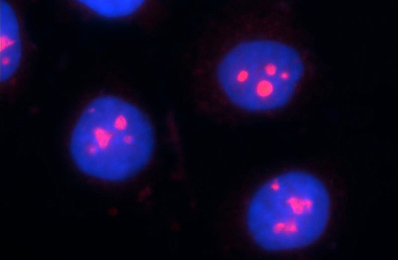 Immunofluorescent analysis of MCF-7 cells using Catalog No:110380(ESF1 Antibody) at dilution of 1:50 and Rhodamine-Goat anti-Rabbit IgG