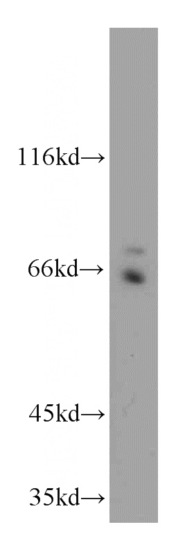 HeLa cells were subjected to SDS PAGE followed by western blot with Catalog No:117081(AXUD1 antibody) at dilution of 1:500