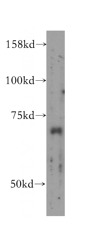 mouse spleen tissue were subjected to SDS PAGE followed by western blot with Catalog No:111779(IL22RA1 antibody) at dilution of 1:400