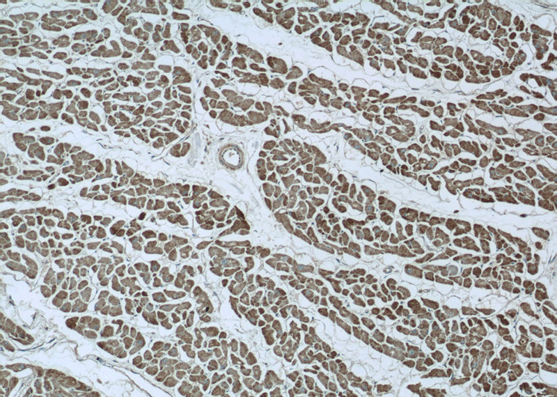 Immunohistochemistry of paraffin-embedded human heart tissue slide using Catalog No:110632(FGF16-Specific Antibody) at dilution of 1:50 (under 10x lens)