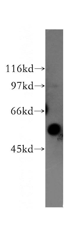 human liver tissue were subjected to SDS PAGE followed by western blot with Catalog No:112062(KIR3DL1 antibody) at dilution of 1:500