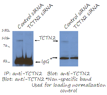 IP result of Human RPE1 cell from Dr. Kevin Corbit. anti-TCTN2(Catalog No:115920).