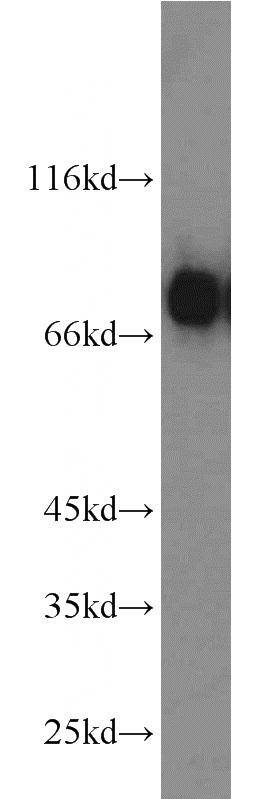 human testis tissue were subjected to SDS PAGE followed by western blot with Catalog No:114664(RHOT2 antibody) at dilution of 1:1000