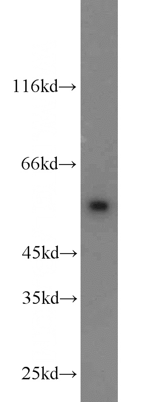 HeLa cells were subjected to SDS PAGE followed by western blot with Catalog No:115416(SMAD2 antibody) at dilution of 1:1000