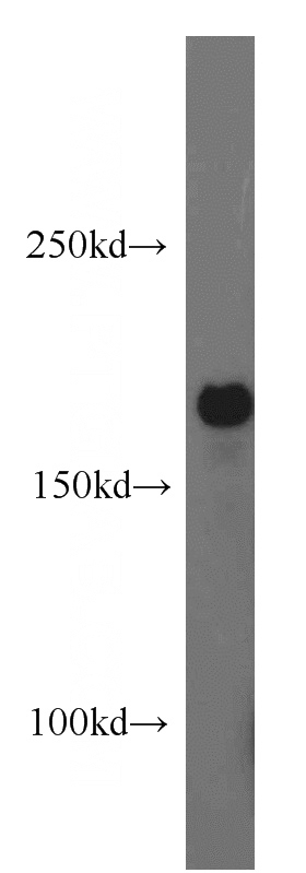 mouse brain tissue were subjected to SDS PAGE followed by western blot with Catalog No:107685(ABCB6 antibody) at dilution of 1:500