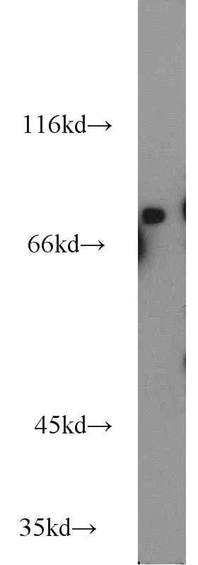 RAW264.7 cells were subjected to SDS PAGE followed by western blot with Catalog No:114479(RASGRP3 antibody) at dilution of 1:800