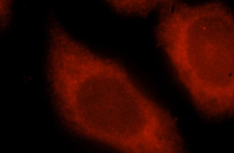 Immunofluorescent analysis of MCF-7 cells, using SNUPN antibody Catalog No:115467 at 1:25 dilution and Rhodamine-labeled goat anti-rabbit IgG (red).