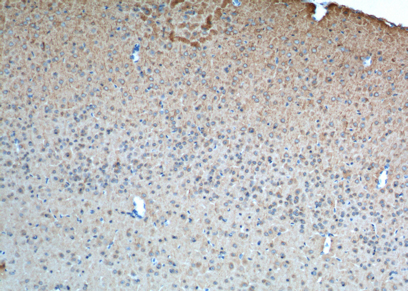 Immunohistochemistry of paraffin-embedded mouse brain tissue slide using Catalog No:108930(CNR1 Antibody) at dilution of 1:100 (under 10x lens). heat mediated antigen retrieved with Tris-EDTA buffer(pH9).