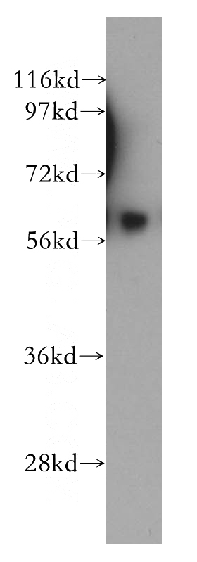 HEK-293 cells were subjected to SDS PAGE followed by western blot with Catalog No:115491(SocS6 antibody) at dilution of 1:500