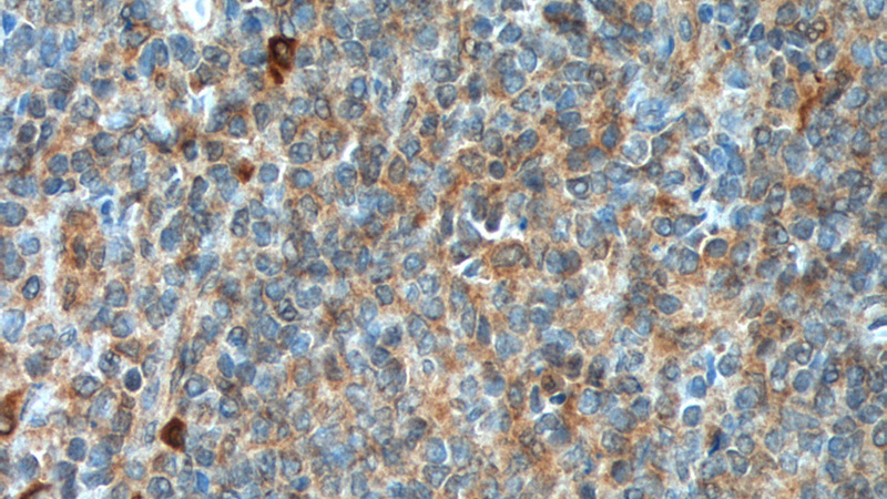 Immunohistochemistry of paraffin-embedded human tonsillitis tissue slide using Catalog No:109009(CD226 Antibody) at dilution of 1:200 (under 40x lens). heat mediated antigen retrieved with Tris-EDTA buffer(pH9).