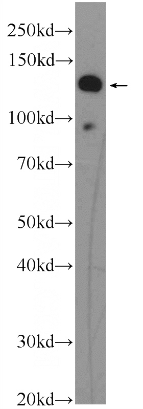SKOV-3 cells were subjected to SDS PAGE followed by western blot with Catalog No:110491(EVI1 Antibody) at dilution of 1:300