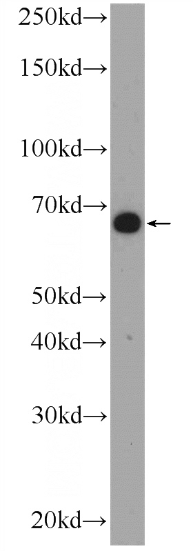 HepG2 cells were subjected to SDS PAGE followed by western blot with Catalog No:108610(C16orf84 Antibody) at dilution of 1:600