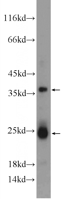 rat liver tissue were subjected to SDS PAGE followed by western blot with Catalog No:116201(TMEM9B Antibody) at dilution of 1:1000