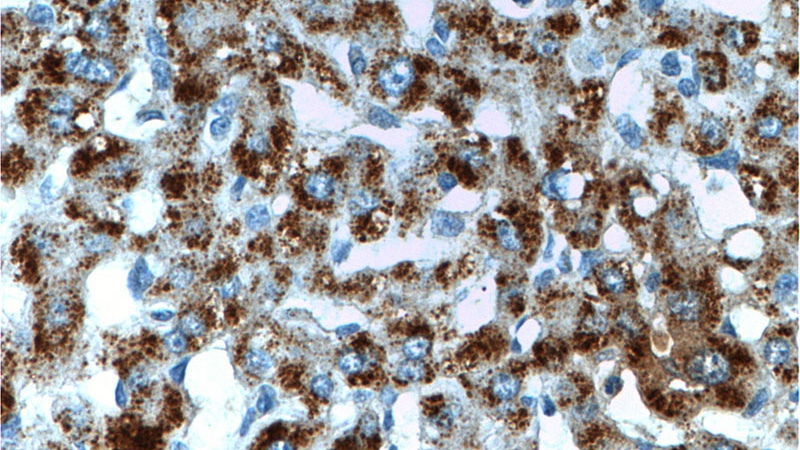 Immunohistochemistry of paraffin-embedded human liver tissue slide using Catalog No:115847(TAOK1 Antibody) at dilution of 1:200 (under 40x lens).