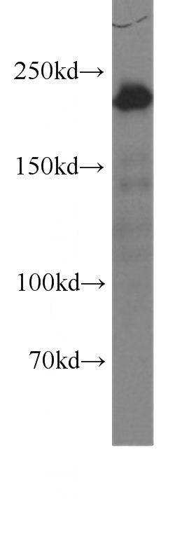 human placenta tissue were subjected to SDS PAGE followed by western blot with Catalog No:107314(MYH9 antibody) at dilution of 1:1000
