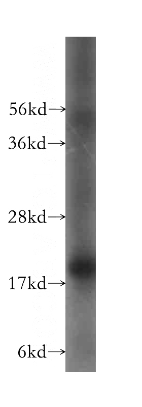 HeLa cells were subjected to SDS PAGE followed by western blot with Catalog No:116700(UXT antibody) at dilution of 1:400