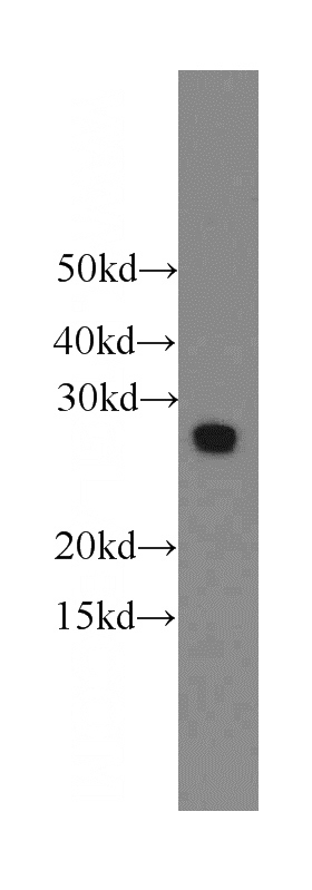 HeLa cells were subjected to SDS PAGE followed by western blot with Catalog No:110260(EIF4E2 antibody) at dilution of 1:500