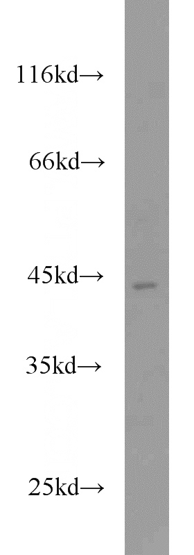 mouse kidney tissue were subjected to SDS PAGE followed by western blot with Catalog No:116838(WNT7A antibody) at dilution of 1:300