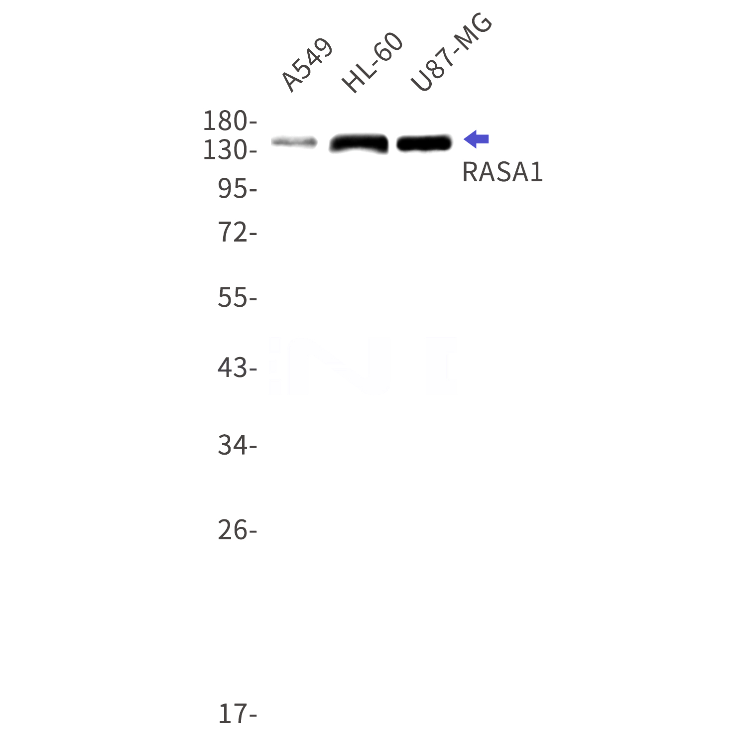 Western blot detection of RASA1 in A549,HL-60,U87-MG cell lysates using RASA1 Rabbit mAb(1:1000 diluted).Predicted band size:116kDa.Observed band size:140kDa.