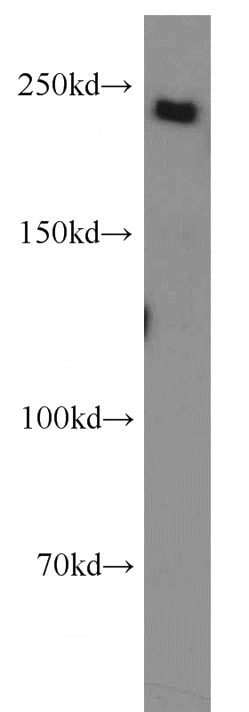 HeLa cells were subjected to SDS PAGE followed by western blot with Catalog No:115742(SUPT6H antibody) at dilution of 1:1000