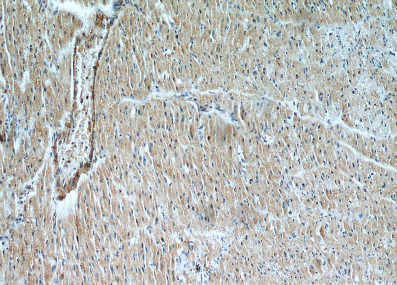 Immunohistochemical of paraffin-embedded human heart using Catalog No:113178(NHLRC1 antibody) at dilution of 1:50 (under 10x lens)
