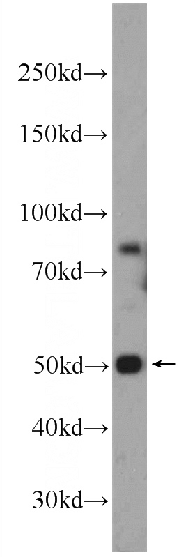 DU 145 cells were subjected to SDS PAGE followed by western blot with Catalog No:108960(CCDC105 antibody) at dilution of 1:1000