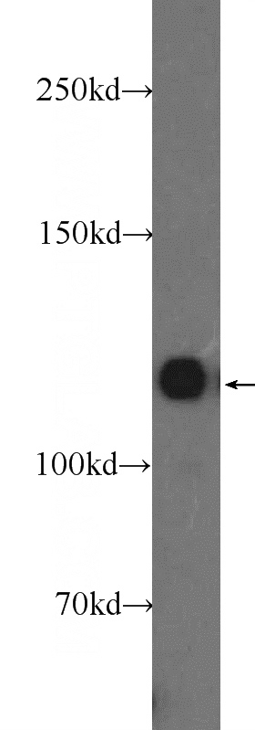 HEK-293 cells were subjected to SDS PAGE followed by western blot with Catalog No:112123(KRI1 Antibody) at dilution of 1:600