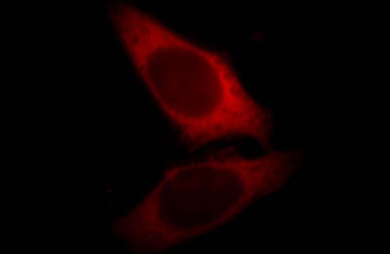 Immunofluorescent analysis of Hela cells, using LASP1 antibody Catalog No:112152 at 1:25 dilution and Rhodamine-labeled goat anti-rabbit IgG (red).