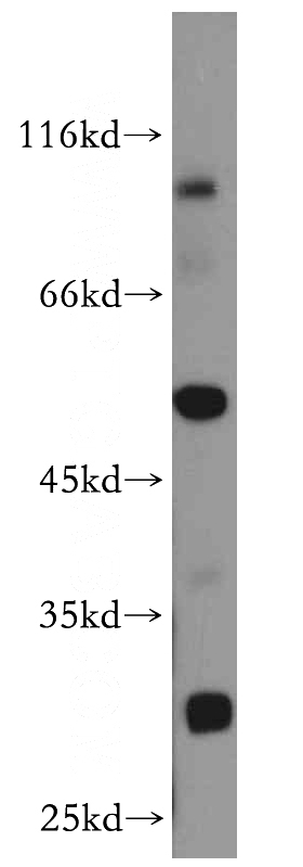 mouse skeletal muscle tissue were subjected to SDS PAGE followed by western blot with Catalog No:110070(DPP7 antibody) at dilution of 1:300