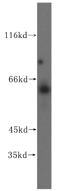 HEK-293 cells were subjected to SDS PAGE followed by western blot with Catalog No:109192(CES1 antibody) at dilution of 1:500