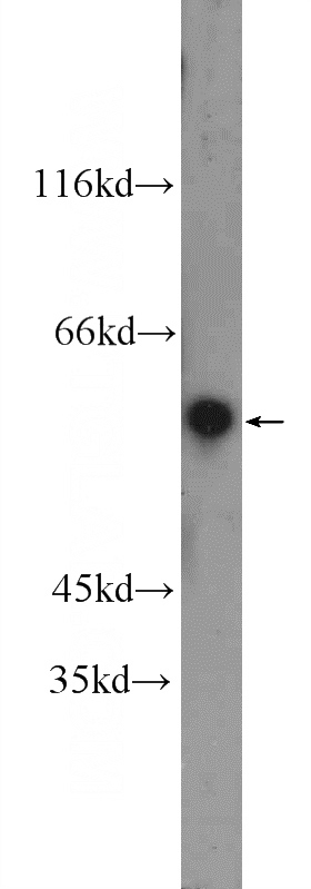 A549 cells were subjected to SDS PAGE followed by western blot with Catalog No:114165(PRAME Antibody) at dilution of 1:300