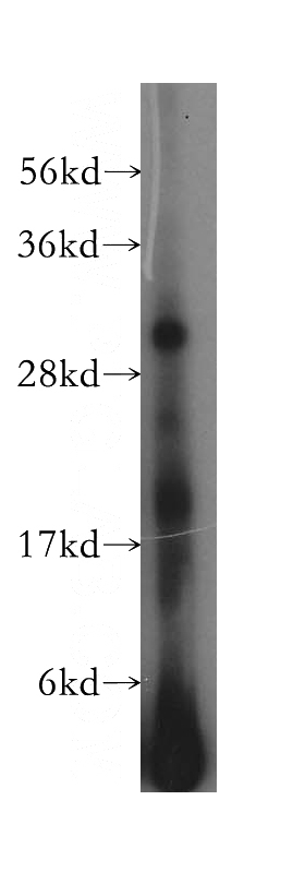 Raji cells were subjected to SDS PAGE followed by western blot with Catalog No:111424(HLA-DQB2 antibody) at dilution of 1:500