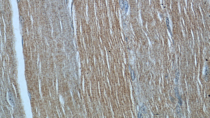 Immunohistochemistry of paraffin-embedded human skeletal muscle tissue slide using Catalog No:107466(PFN2 Antibody) at dilution of 1:50 (under 40x lens)