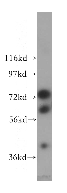 HeLa cells were subjected to SDS PAGE followed by western blot with Catalog No:109831(DDX43 antibody) at dilution of 1:800