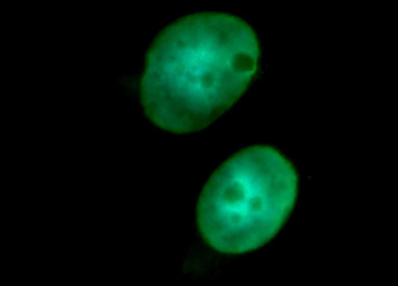 Immunofluorescent analysis of SH-SY5Y cells, using SNRPN antibody Catalog No:115466 at 1:50 dilution and FITC-labeled donkey anti-rabbit IgG(green). Blue pseudocolor = DAPI (fluorescent DNA dye).